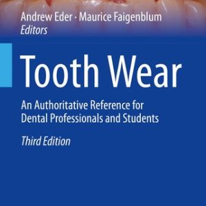 Tooth Wear (An Authoritative Reference for Dental Professionals and Students) (3rd Edition)
