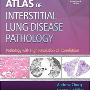 Atlas of Interstitial Lung Disease Pathology: Pathology with High Resolution CT Correlations