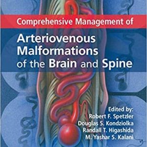 Comprehensive Management of Arteriovenous Malformations of the Brain and Spine