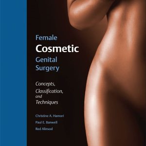 Female Cosmetic Genital Surgery: Concepts; Classification; and Techniques