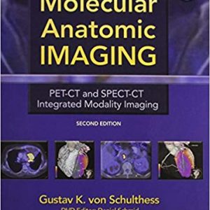 Molecular Anatomic Imaging: PET-CT and SPECT-CT Integrated Modality Imaging (2nd Edition)