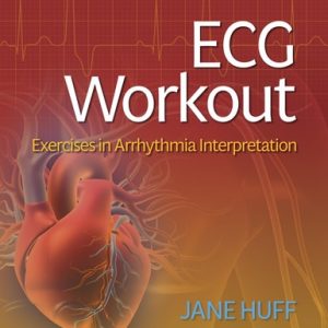 ECG Workout Exercises in Arrhythmia Interpretation (8th Edition)