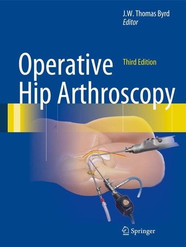 Operative Hip Arthroscopy (3rd Edition)