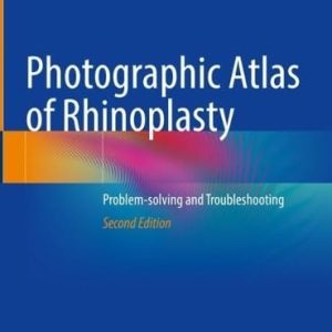 Photographic Atlas of Rhinoplasty (Problem-solving and Troubleshooting) (2nd Edition)