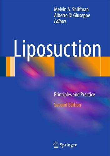 Liposuction (Principles and Practice) (2nd Edition)