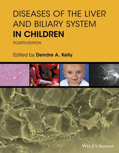 Diseases of the Liver and Biliary System in Children (4th Edition)