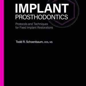 Implant Prosthodontics Protocols and Techniques for Fixed Implant Restorations (1st Edition)