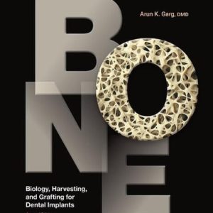 Bone: Biology, Harvesting, and Grafting for Dental Implants (2nd Edition)