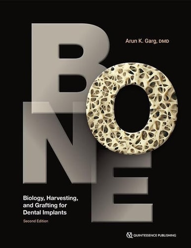 Bone: Biology, Harvesting, and Grafting for Dental Implants (2nd Edition)