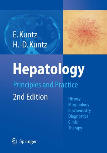 Hepatology, Principles and Practice (History, Morphology, Biochemistry, Diagnostics, Clinic, Therapy) (2nd Edition)