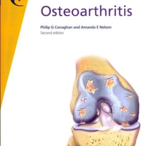 Fast Facts: Osteoarthritis (2nd Edition)