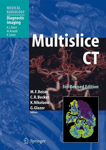 Multislice CT (3rd Edition)
