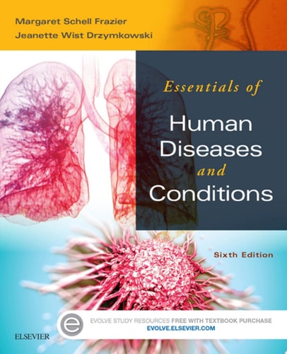 Essentials of Human Diseases and Conditions (6th Edition)