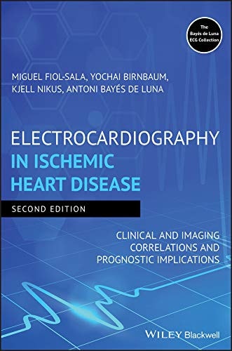 Electrocardiography in Ischemic Heart Disease (Clinical and Imaging Correlations and Prognostic Implications) (2nd Edition)