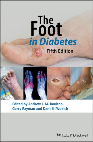 The Foot in Diabetes, 5th Edition