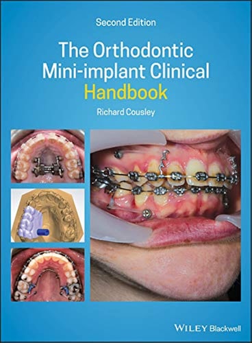 The Orthodontic Mini-implant Clinical Handbook (2nd Edition)