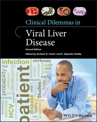 Clinical Dilemmas in Viral Liver Disease (2nd Edition)