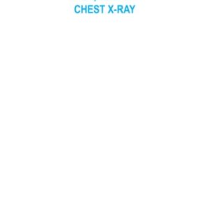 Interpretation of Chest X-Ray An Illustrated Companion (1st Edition)