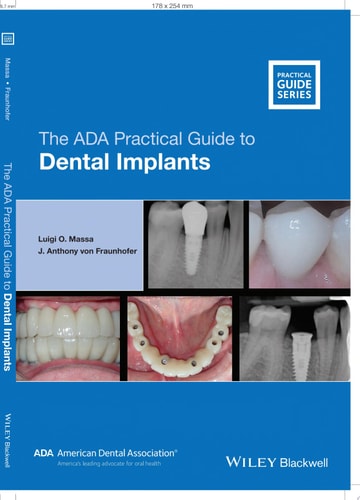 The ADA Practical Guide to Dental Implants (1st Edition)