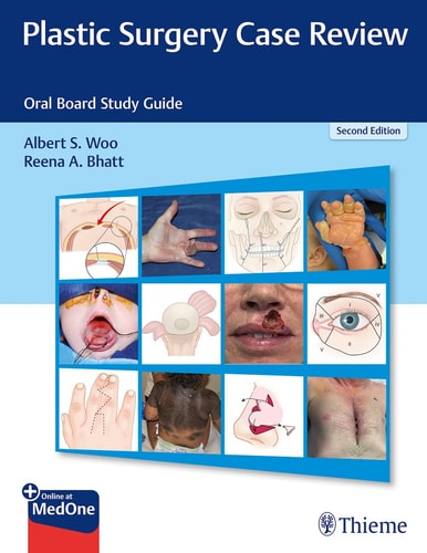 Plastic Surgery Case Review (Oral Board Study Guide) (2nd Edition)