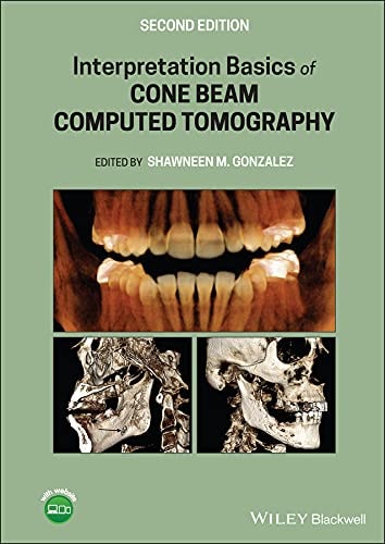 Interpretation Basics of Cone Beam Computed Tomography (2nd Edition)