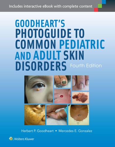 Goodheart's Photoguide to Common Pediatric and Adult Skin Disorders (4th Edition)