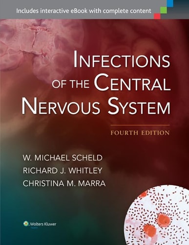 Infections of the Central Nervous System (4th Edition)
