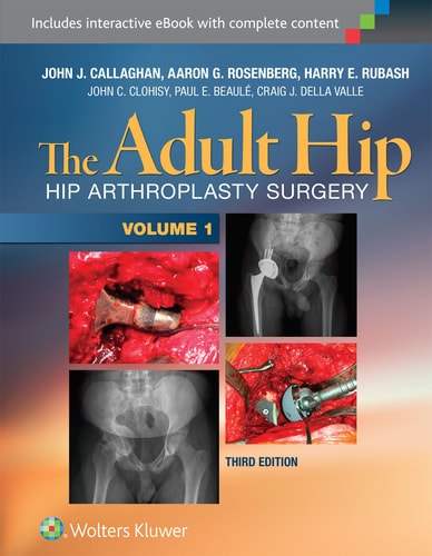 The Adult Hip (Hip Arthroplasty Surgery) (3rd Edition)