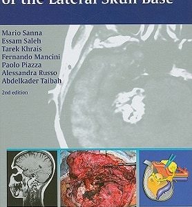 Atlas of Microsurgery of the Lateral Skull Base (2nd Edition)