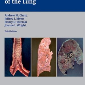 Thurlbeck's Pathology of the Lung (3rd Edition)
