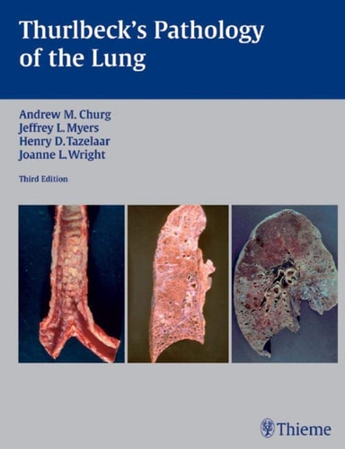 Thurlbeck's Pathology of the Lung (3rd Edition)