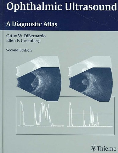 Ophthalmic Ultrasound (A Diagnostic Atlas) (2nd Edition)