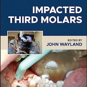 Impacted Third Molars (2nd Edition)