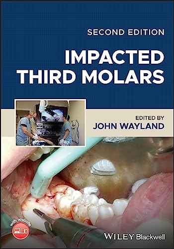Impacted Third Molars (2nd Edition)