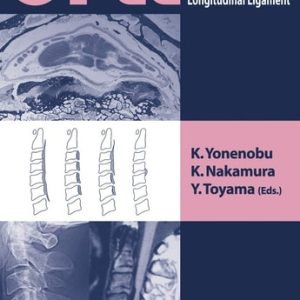 OPLL (Ossification of the Posterior Longitudinal Ligament) (2nd Edition)