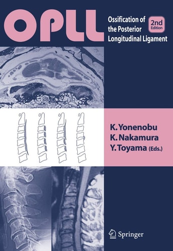 OPLL (Ossification of the Posterior Longitudinal Ligament) (2nd Edition)