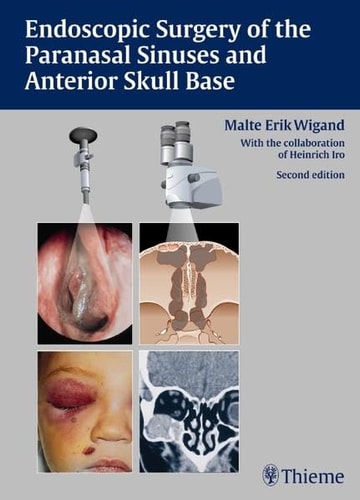 Endoscopic Surgery of the Paranasal Sinuses and Anterior Skull Base (2nd Edition)