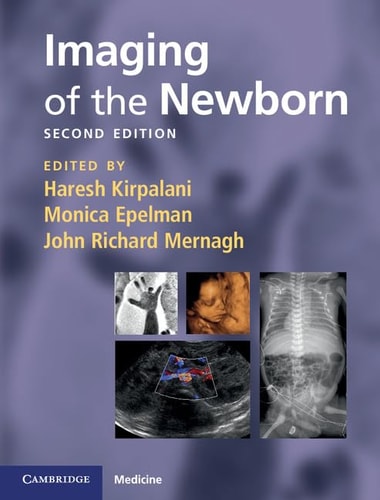 Imaging of the Newborn (2nd Edition)