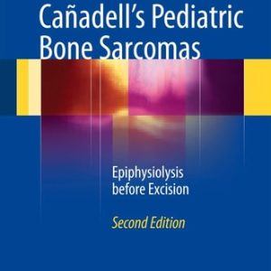 Cañadell's Pediatric Bone Sarcomas (Epiphysiolysis before Excision) (2nd Edition)