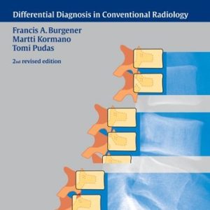 Bone and Joint Disorders