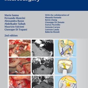 Atlas of Acoustic Neurinoma Microsurgery (2nd Edition)