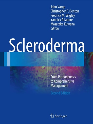 Scleroderma (From Pathogenesis to Comprehensive Management) (2nd Edition)