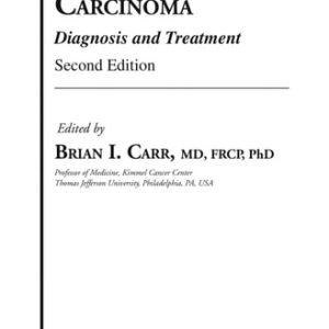 Hepatocellular Carcinoma (Diagnosis and Treatment) (2nd Edition)