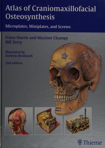 Atlas of Craniomaxillofacial Osteosynthesis (Microplates, Miniplates, and Screws) (2nd Edition)