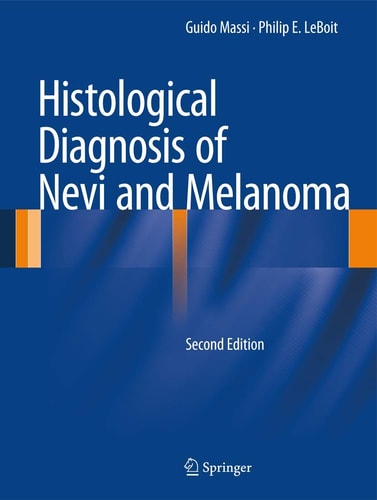 Histological Diagnosis of Nevi and Melanoma (2nd Edition)
