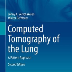 Computed Tomography of the Lung (A Pattern Approach) (2nd Edition)