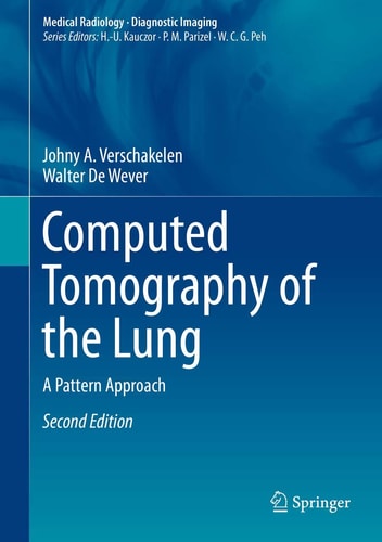 Computed Tomography of the Lung (A Pattern Approach) (2nd Edition)