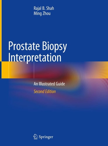 Prostate Biopsy Interpretation (An Illustrated Guide) (2nd Edition)