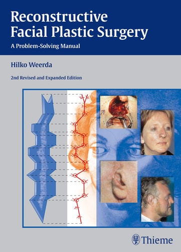 Reconstructive Facial Plastic Surgery (A Problem-Solving Manual) (2nd Edition)