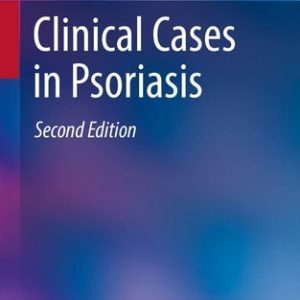 Clinical Cases in Psoriasis (2nd Edition)